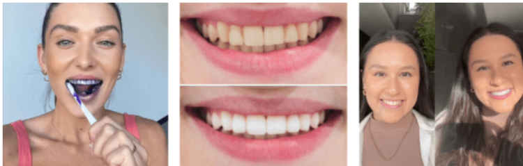 WellaWhite Teeth Whitening Foam Customer Reviews